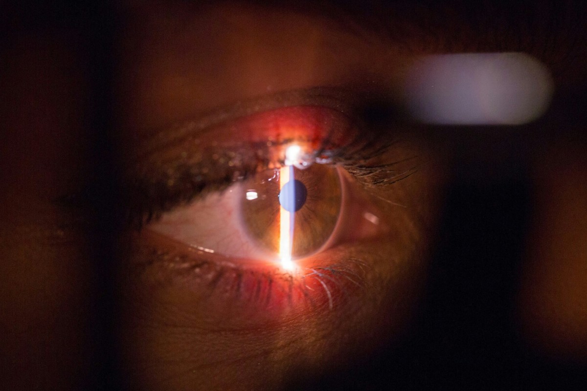 Boots Opticians launches eye-scan that can detect serious health conditions