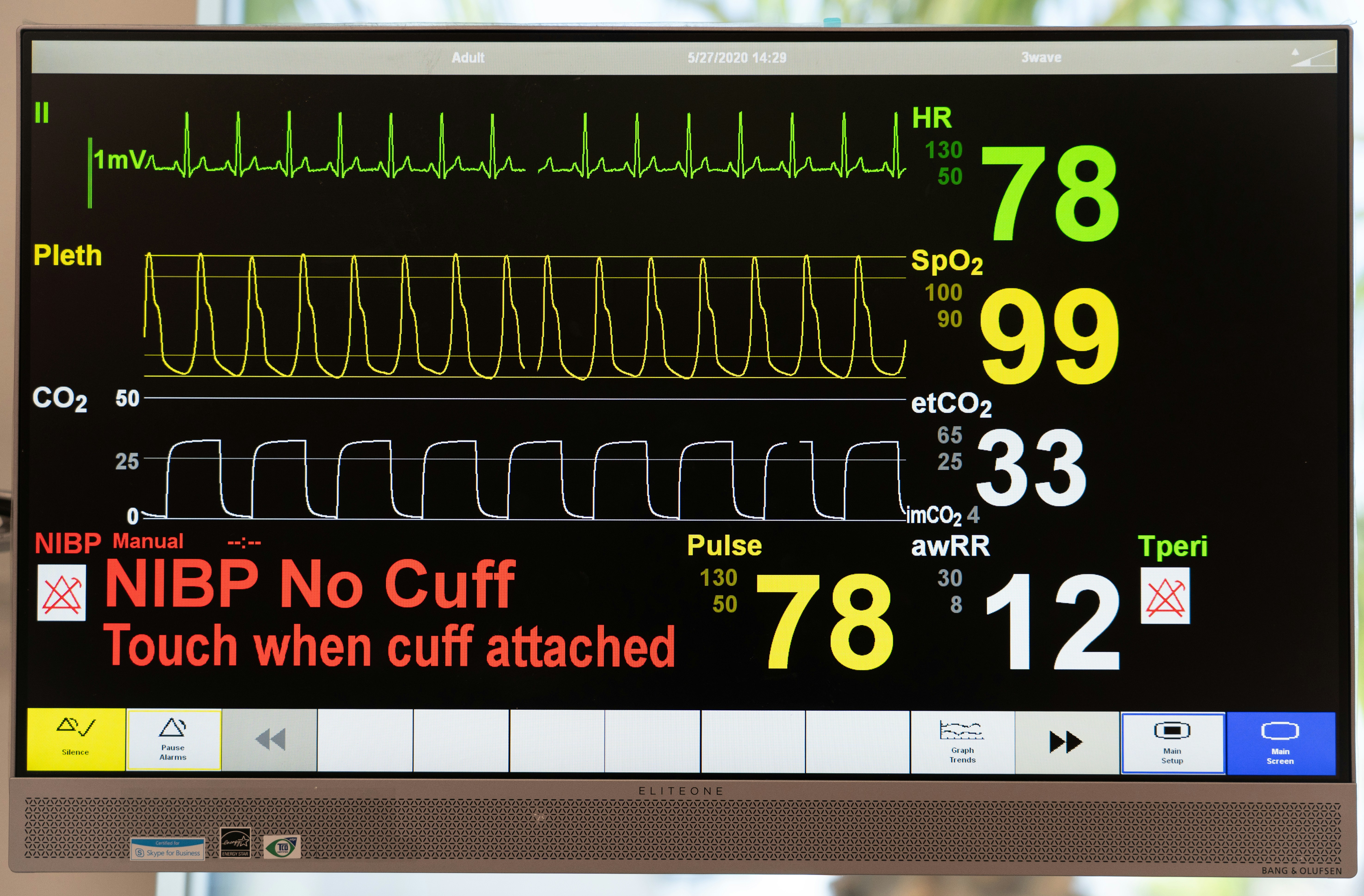 North Tees NHS streamlines intensive care admissions