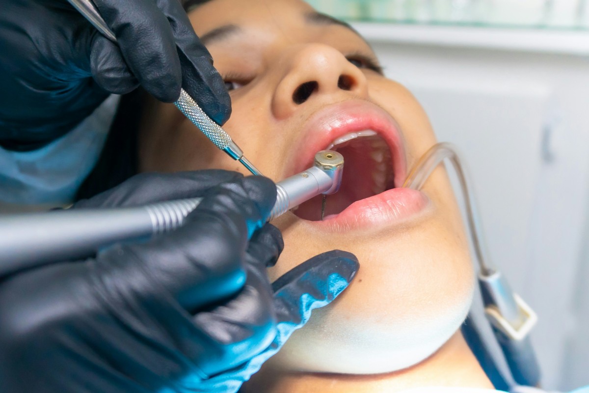 Dental recovery plan 'unlikely' to deliver target of 1.5m additional treatments