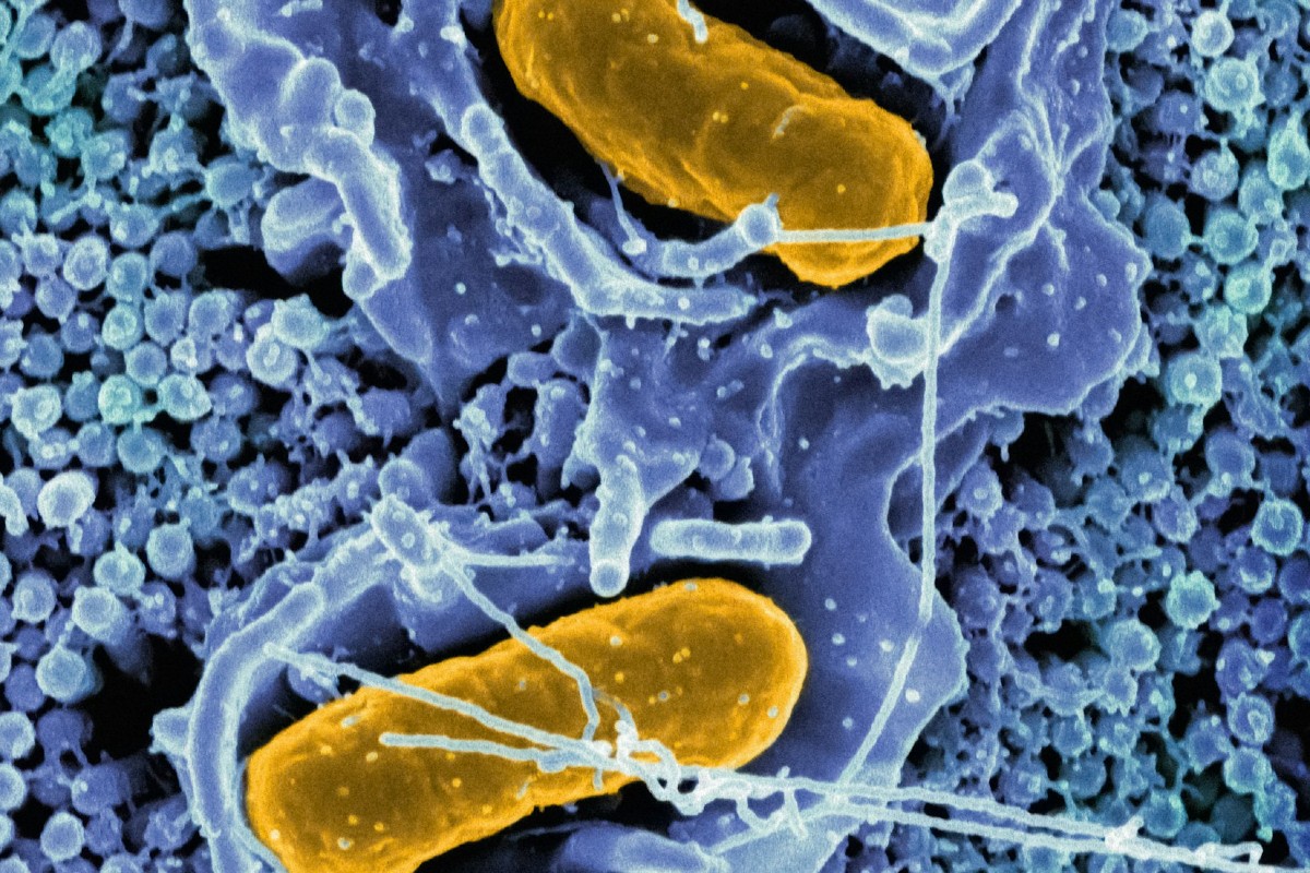 Welsh Government to roll out rapid diagnostic testing for bacterial infections in primary care