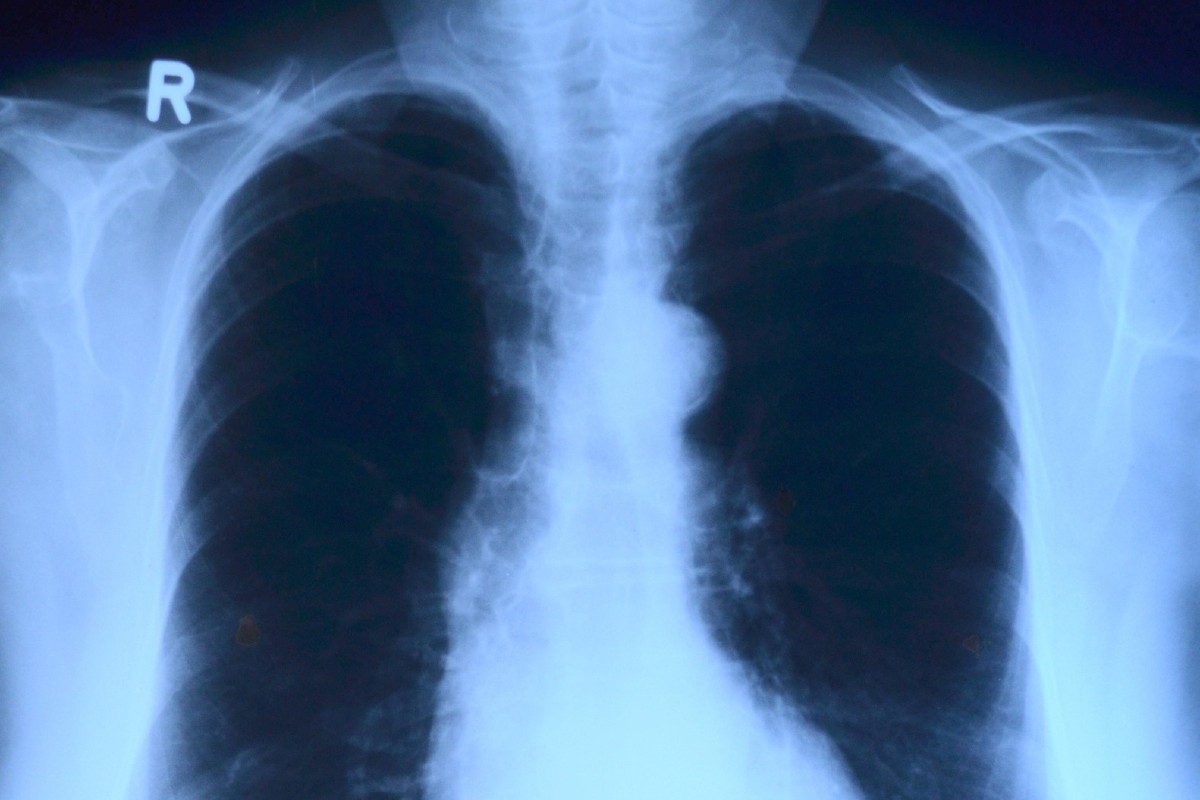 Challenges facing radiology and clinical oncology laid bare 
