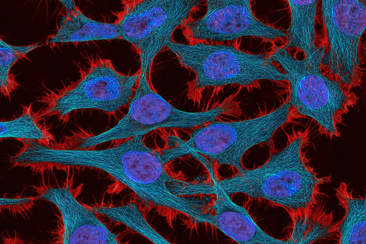 NHS England to add at-home HPV testing to cervical screening programme