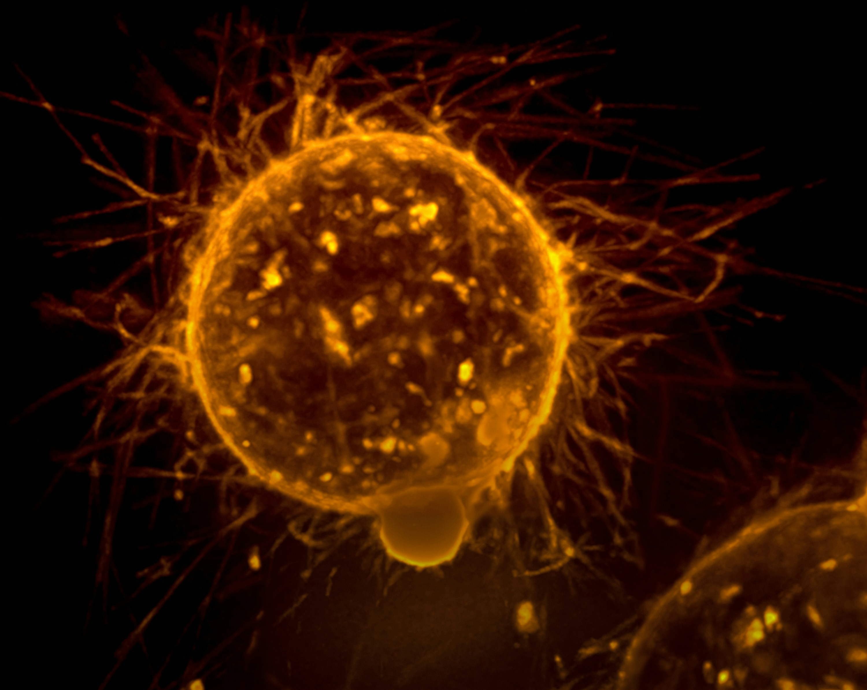Urgent action needed on acute and supportive oncology, doctors say