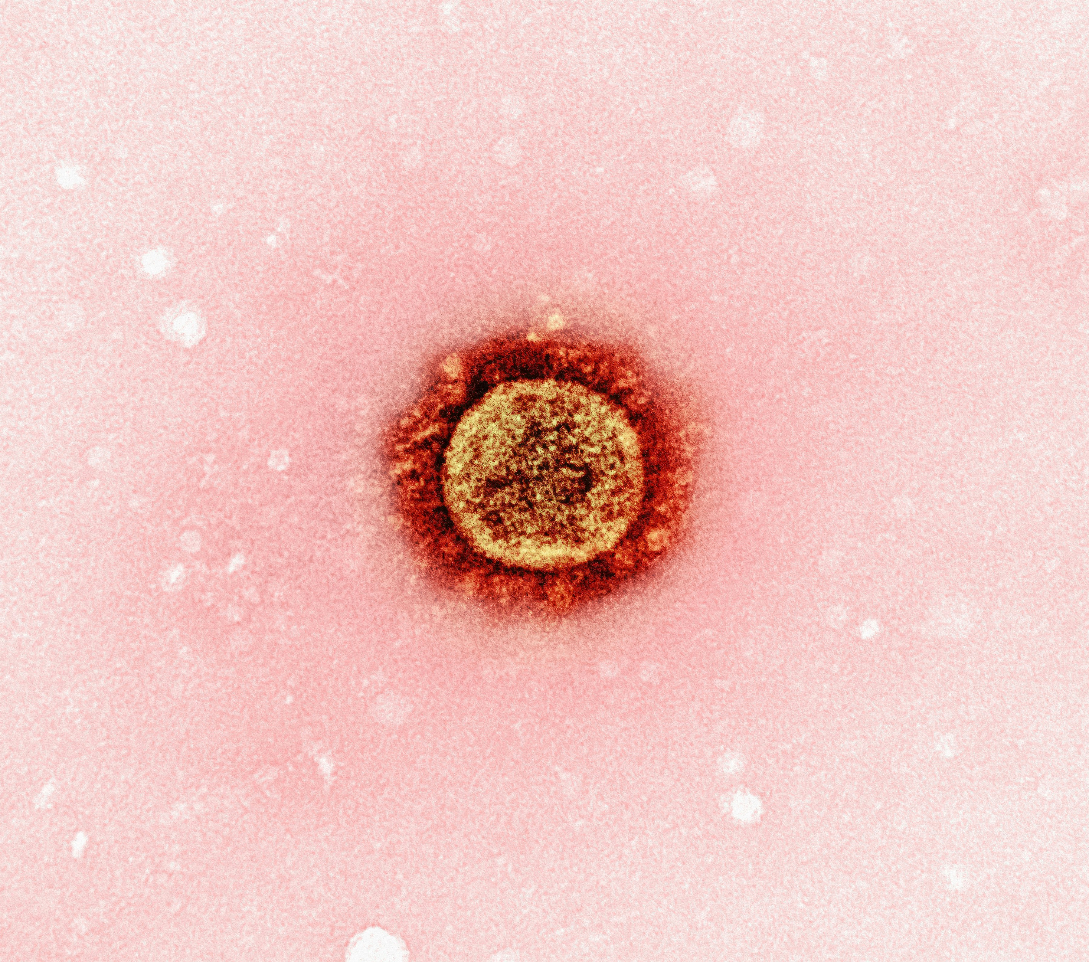 UKHSA reports two measles deaths this year 