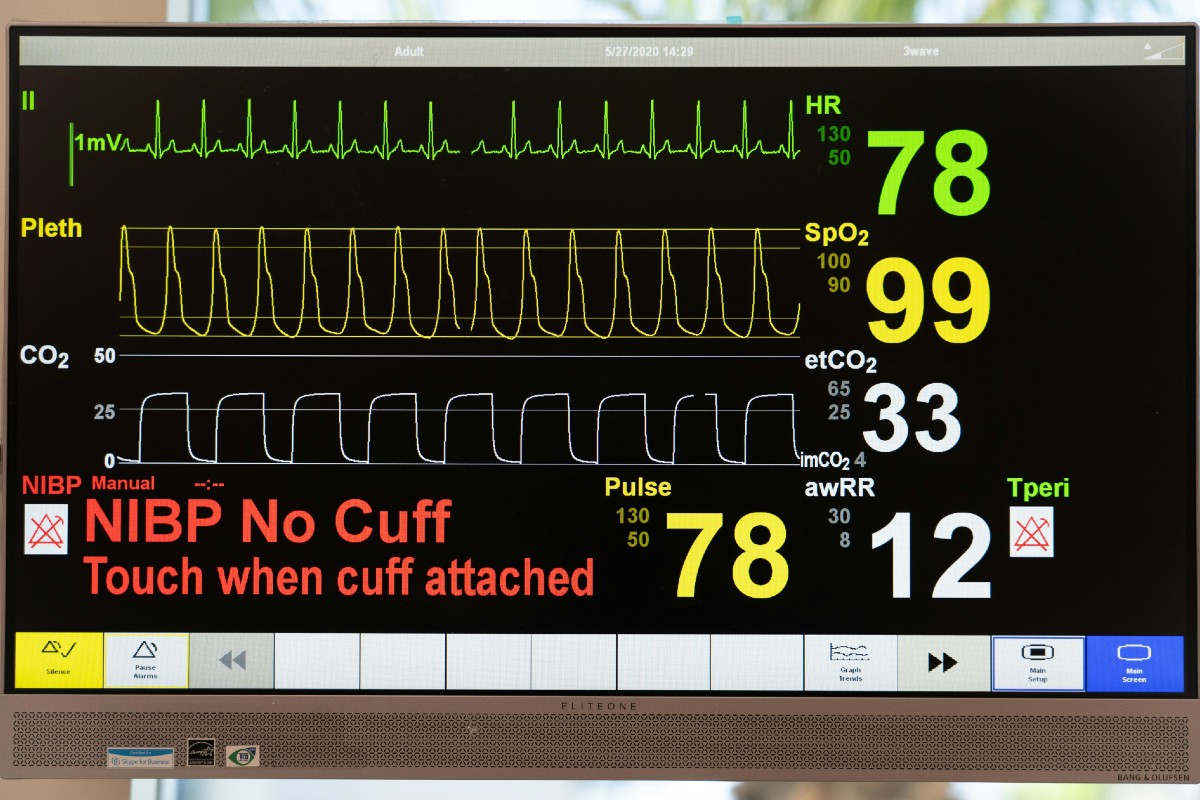 Barts Health seeks real-time continuous vital signs monitoring system