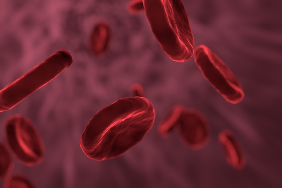 NHS drive aims to find undiagnosed infected blood patients