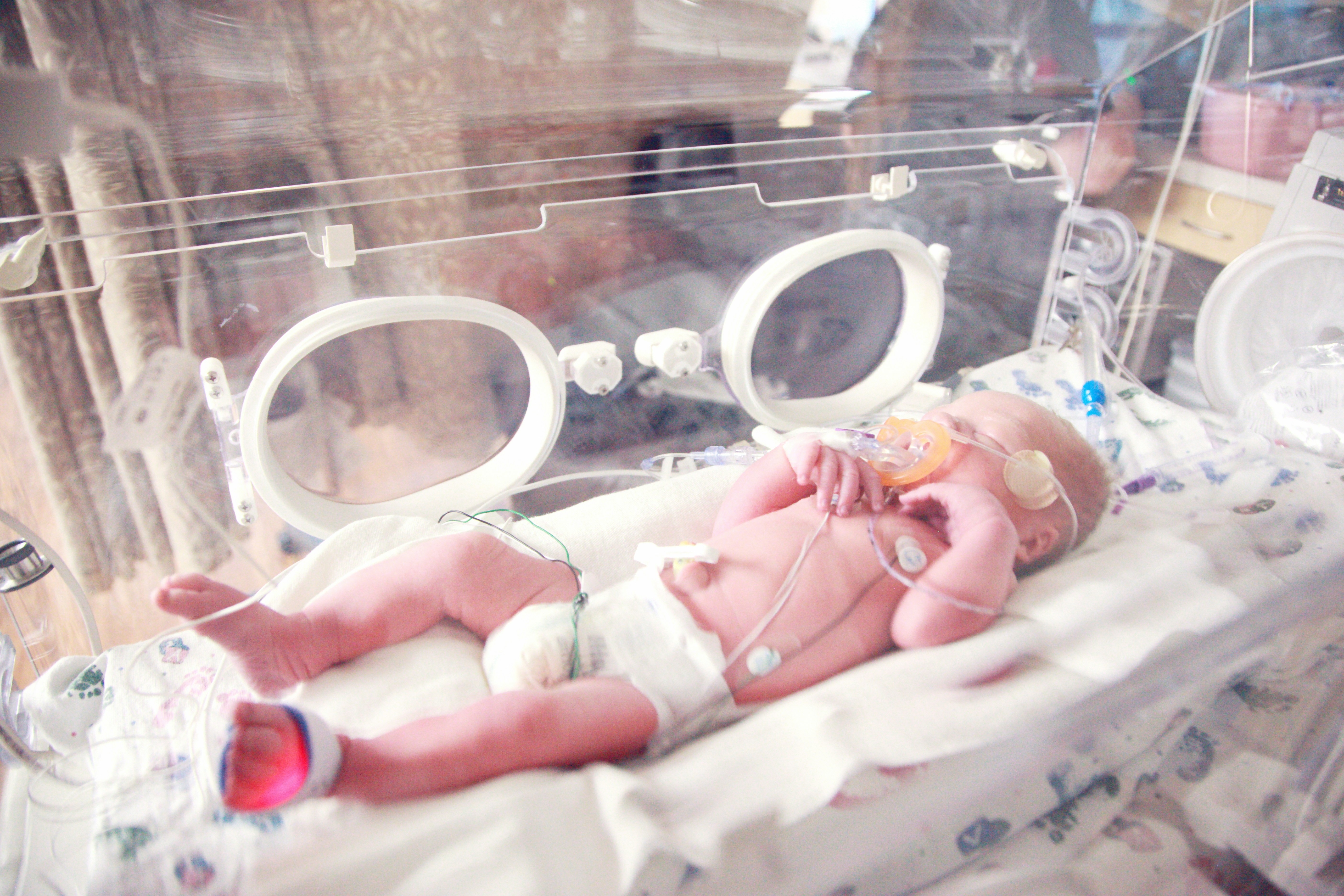 Report warns national target for preterm birth will not be met